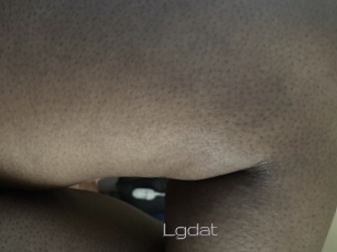 Lgdat